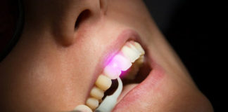 استخدامات الليزر في طب الاسنان