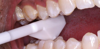 الاختبارات التشخيصية في علاج الجذور Endodontic tests