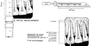 أفضل المحاضرات لتعلم Working length determination