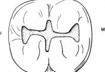 Cavity preparation platform