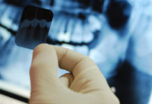 Dental Radiographic interpretation platform