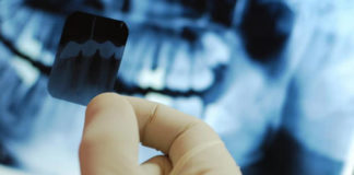 Dental Radiographic interpretation platform