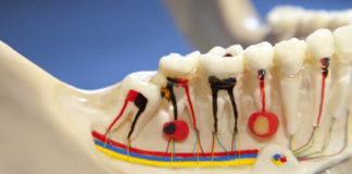 Endodontic RCT Step by step platform