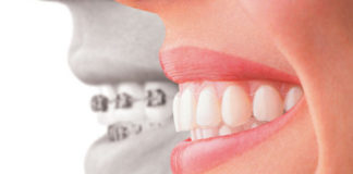 Orthodontics platform