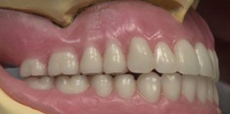 Removable Prosthodontics platform