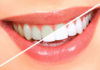 Teeth Bleaching platform