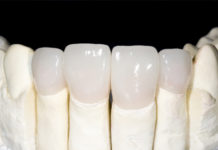 Zirconia Crowns platform