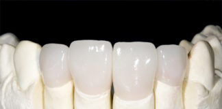 Zirconia Crowns platform