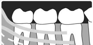 Mandibular Molars Radiographic landmarks