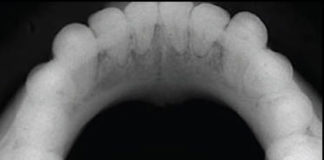 Mandibular Occlusal Cross-sectional landmarks