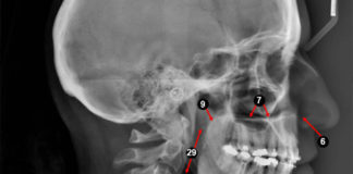 Lateral cephalometric view