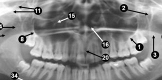 Panoramic radiograph landmarks