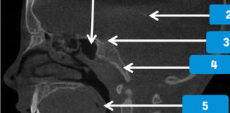 Sagittal view landmarks