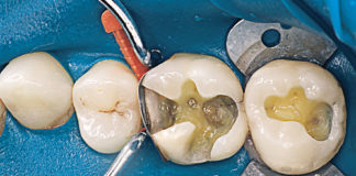 Operative dentistry - Dentistry online