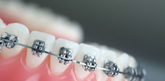 Orthodontics - Dentistry online