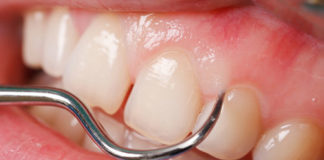 Periodontics - Dentistry online