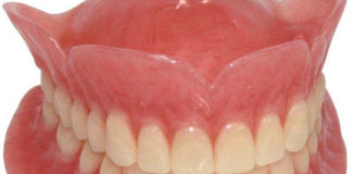 Removable Prosthodontics - Dentistry online