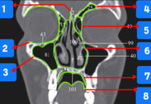 CT Radiographic landmarks - Quiz