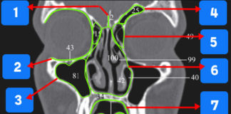 CT Radiographic landmarks - Quiz