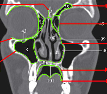 CT Radiographic landmarks - Quiz