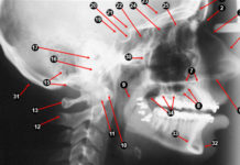 Extra-oral Radiographic landmarks - Quiz