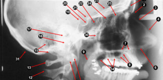 Extra-oral Radiographic landmarks - Quiz