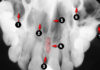 Occlusal Radiographic landmarks - Quiz