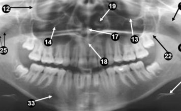 Panoramic Radiographic landmarks - Quiz